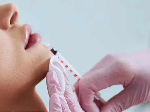 Stock photograph of a model: woman in profile with eyes closed as gloved hands hold a syringe near her lips.