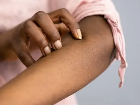 Stock photograph of a model: woman in a pink top scratching her forearm with her other hand.