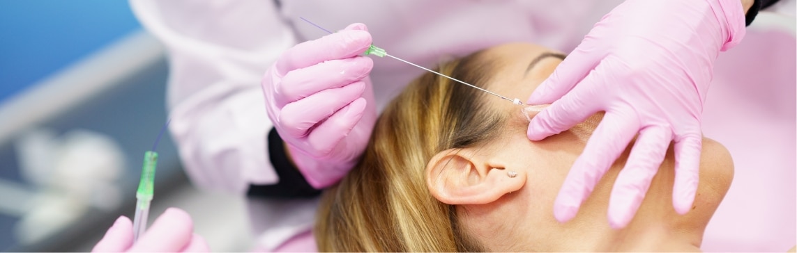 Stock photograph of a model: gloved hands guide a thin thread needle at a woman's temple during a facial procedure.