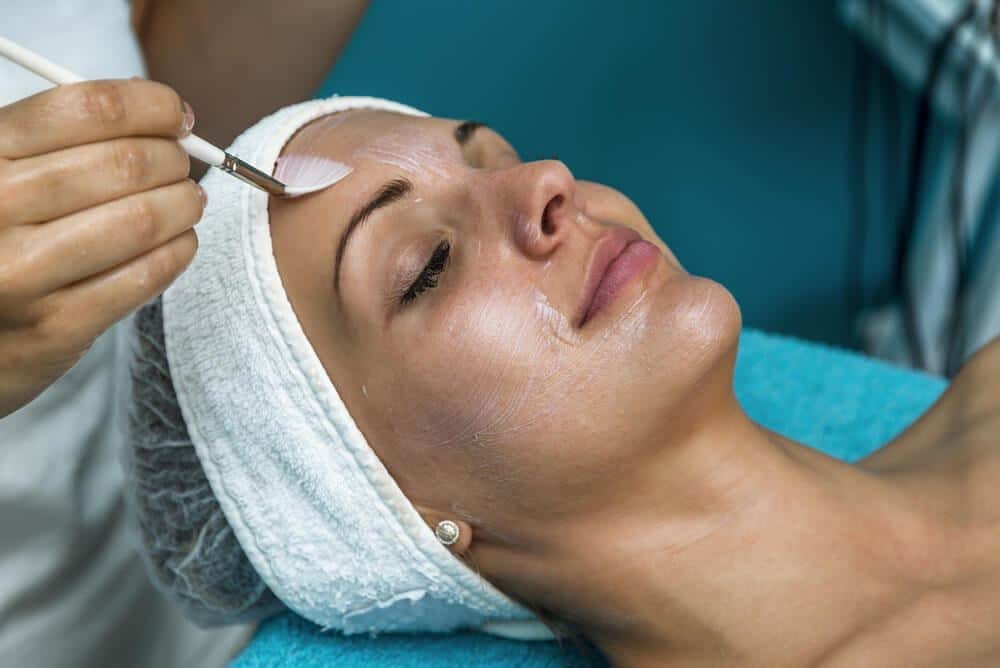 Chemical Peel