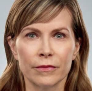 After Image: Fillers