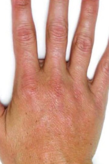 After Image: Fillers - front