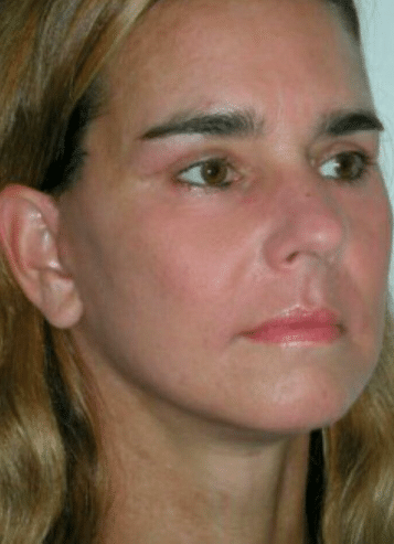 After Image: NovaThreads - right-front-oblique