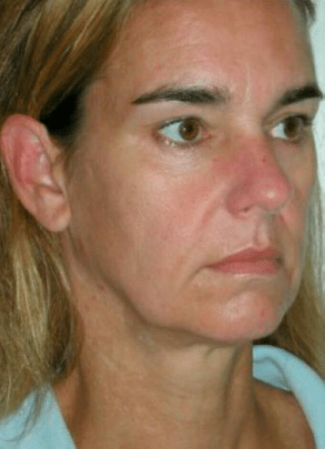 Before Image: NovaThreads - right-front-oblique