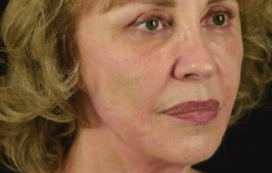Before Image: NovaThreads - right-front-oblique