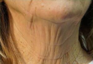Before Image: NovaThreads
